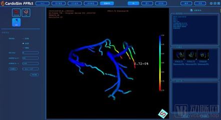 生物流体力学赋能精准医疗，晟视科技近亿元Pre-A轮融资引领超声技术创新